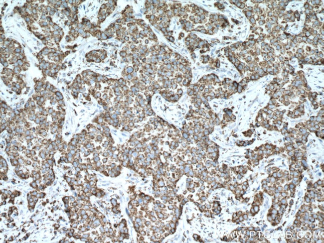 PCK2 Antibody in Immunohistochemistry (Paraffin) (IHC (P))