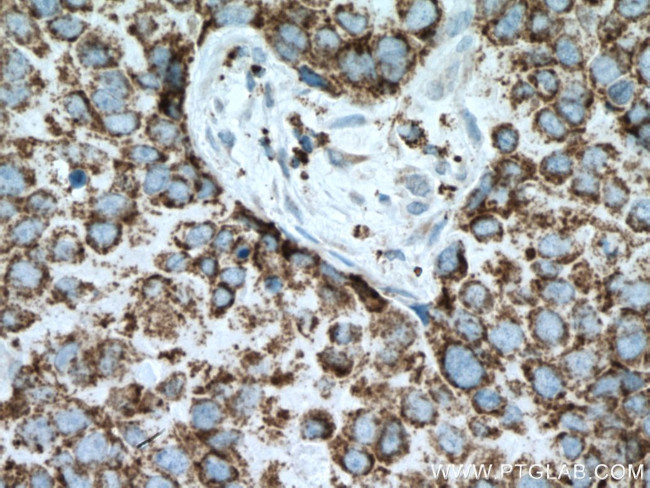 PCK2 Antibody in Immunohistochemistry (Paraffin) (IHC (P))