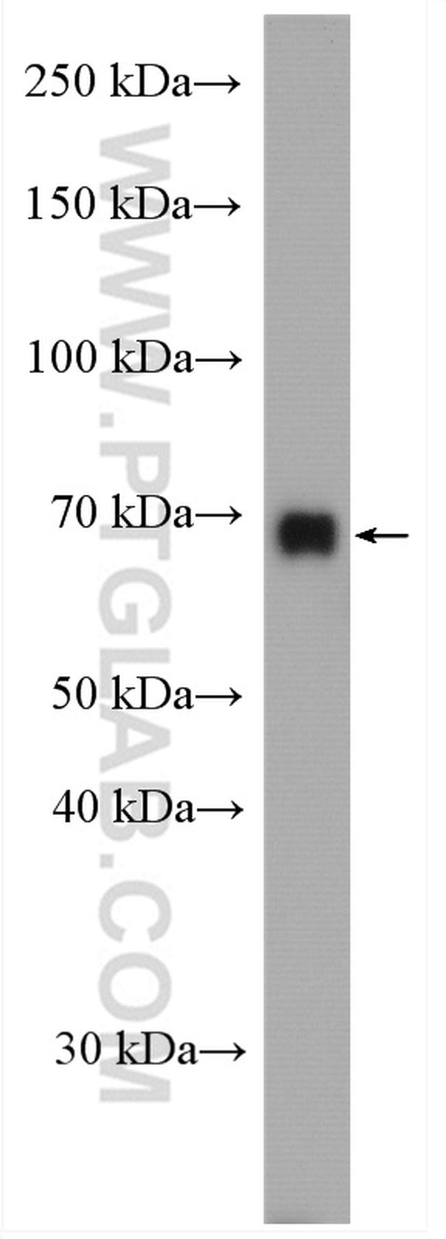 PCK2 Antibody in Western Blot (WB)