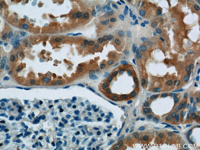 ATP5D Antibody in Immunohistochemistry (Paraffin) (IHC (P))