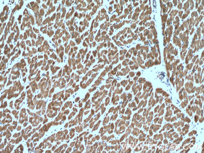 RBX1 Antibody in Immunohistochemistry (Paraffin) (IHC (P))