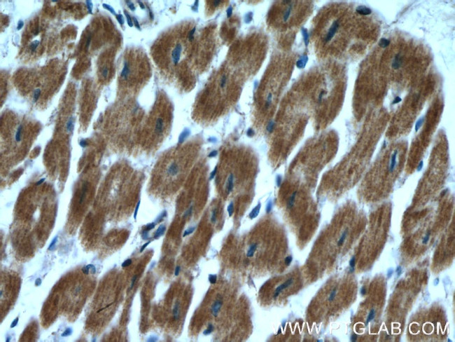 RBX1 Antibody in Immunohistochemistry (Paraffin) (IHC (P))