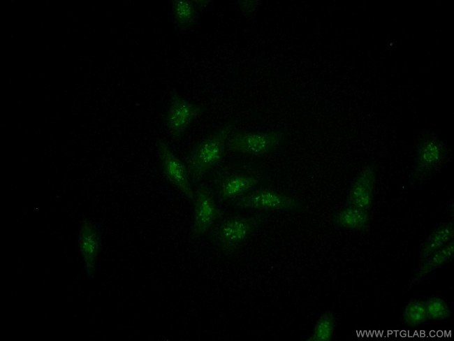 RRP1 Antibody in Immunocytochemistry (ICC/IF)