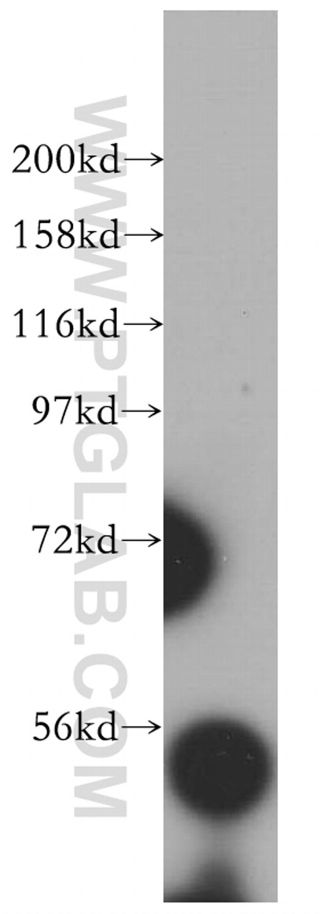 RRP1 Antibody in Western Blot (WB)