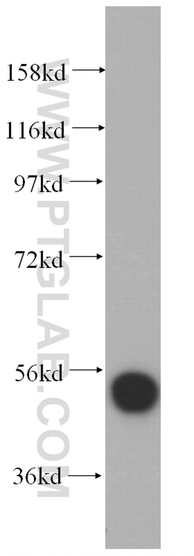 RRP1 Antibody in Western Blot (WB)