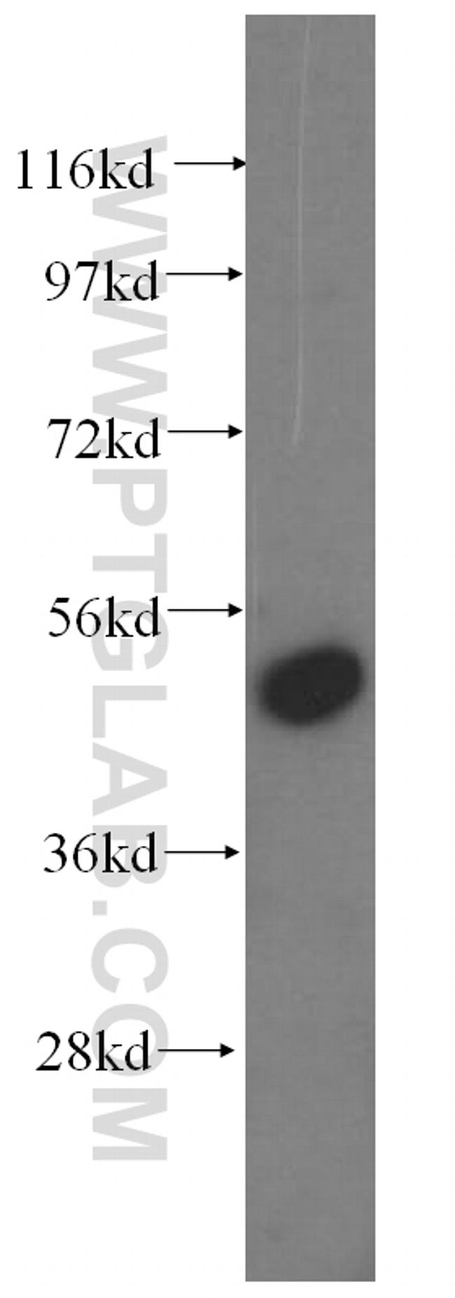 RRP1 Antibody in Western Blot (WB)