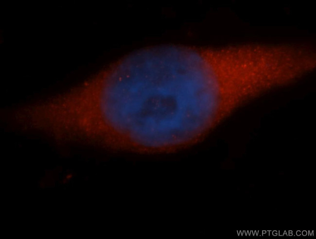 NAP1L1 Antibody in Immunocytochemistry (ICC/IF)