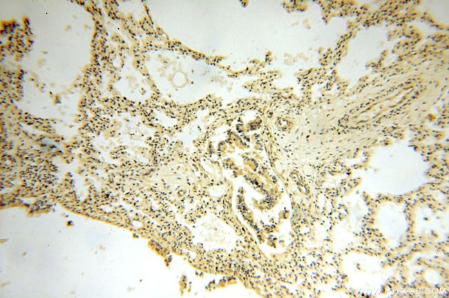 NAP1L1 Antibody in Immunohistochemistry (Paraffin) (IHC (P))