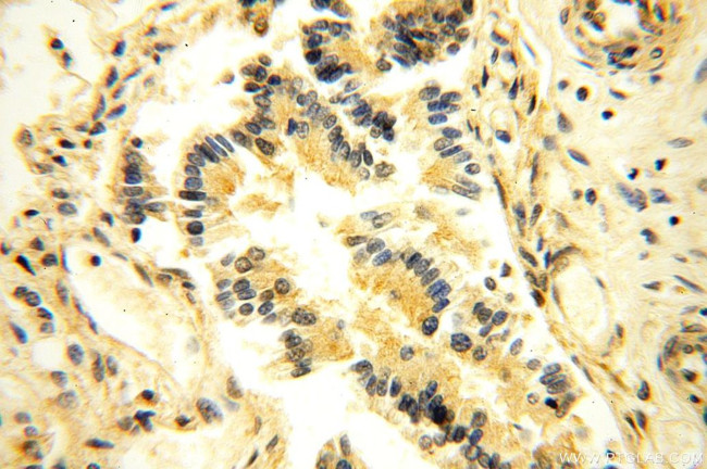 NAP1L1 Antibody in Immunohistochemistry (Paraffin) (IHC (P))