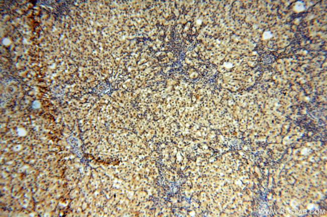 NAP1L1 Antibody in Immunohistochemistry (Paraffin) (IHC (P))