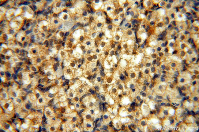 NAP1L1 Antibody in Immunohistochemistry (Paraffin) (IHC (P))