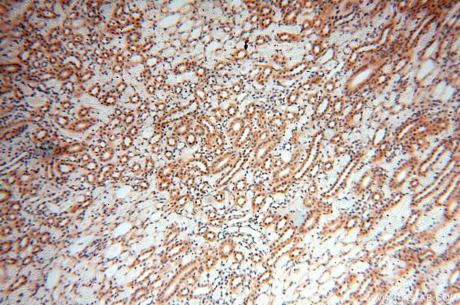 NAP1L1 Antibody in Immunohistochemistry (Paraffin) (IHC (P))