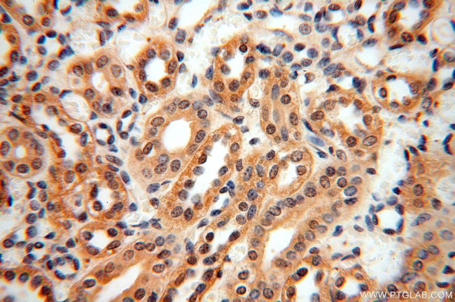 NAP1L1 Antibody in Immunohistochemistry (Paraffin) (IHC (P))