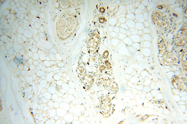 NAP1L1 Antibody in Immunohistochemistry (Paraffin) (IHC (P))