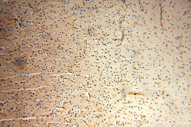 NAP1L1 Antibody in Immunohistochemistry (Paraffin) (IHC (P))