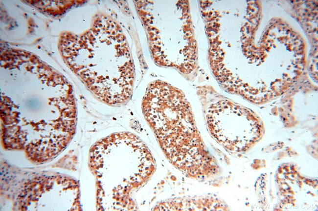 NAP1L1 Antibody in Immunohistochemistry (Paraffin) (IHC (P))