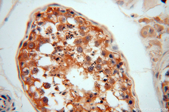 NAP1L1 Antibody in Immunohistochemistry (Paraffin) (IHC (P))