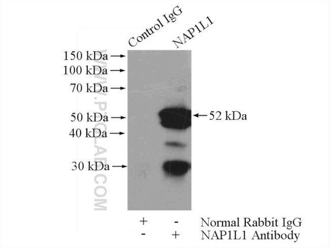 NAP1L1 Antibody in Immunoprecipitation (IP)