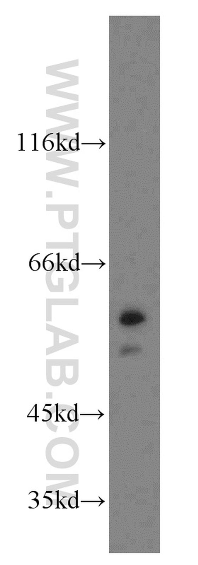 NAP1L1 Antibody in Western Blot (WB)