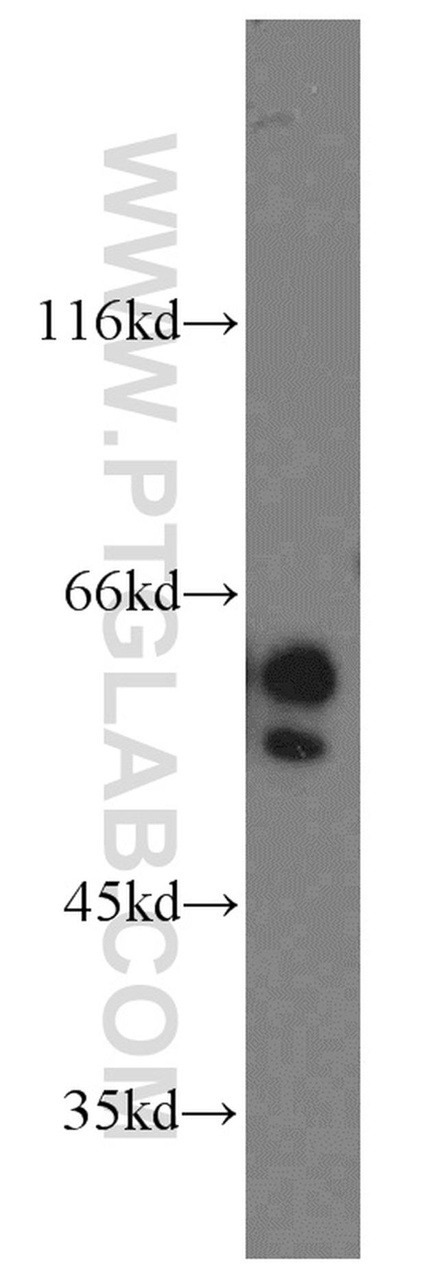 NAP1L1 Antibody in Western Blot (WB)