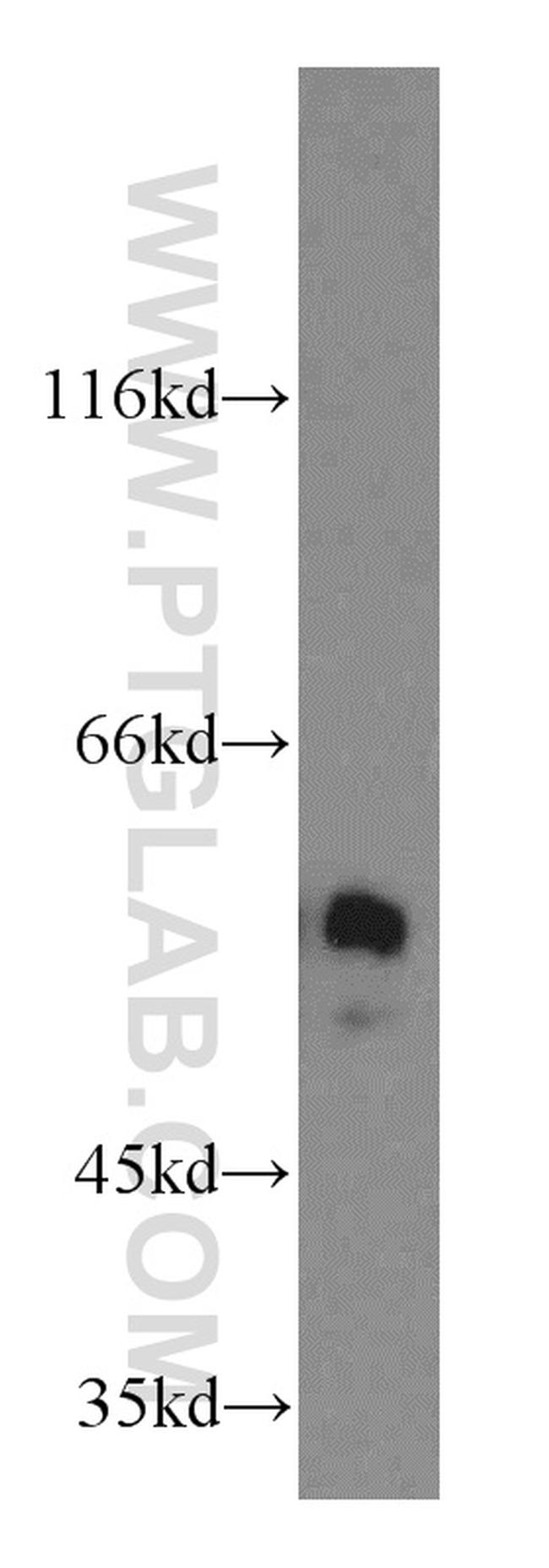 NAP1L1 Antibody in Western Blot (WB)