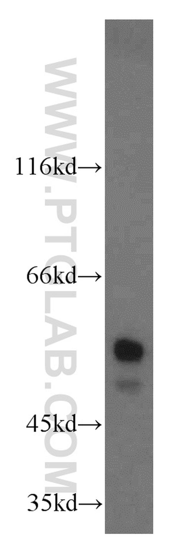 NAP1L1 Antibody in Western Blot (WB)