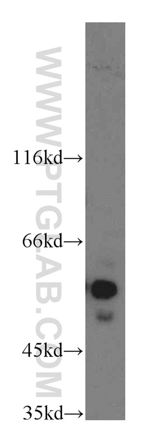 NAP1L1 Antibody in Western Blot (WB)