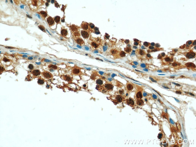 PSMD4 Antibody in Immunohistochemistry (Paraffin) (IHC (P))