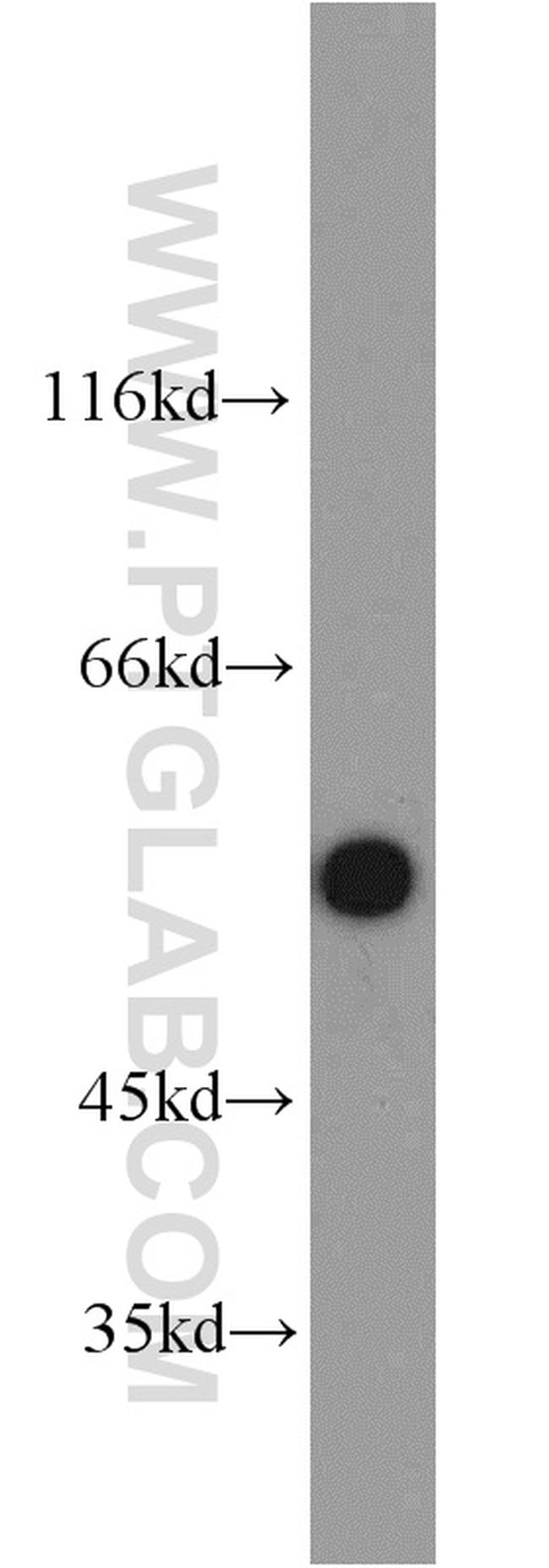 PSMD4 Antibody in Western Blot (WB)