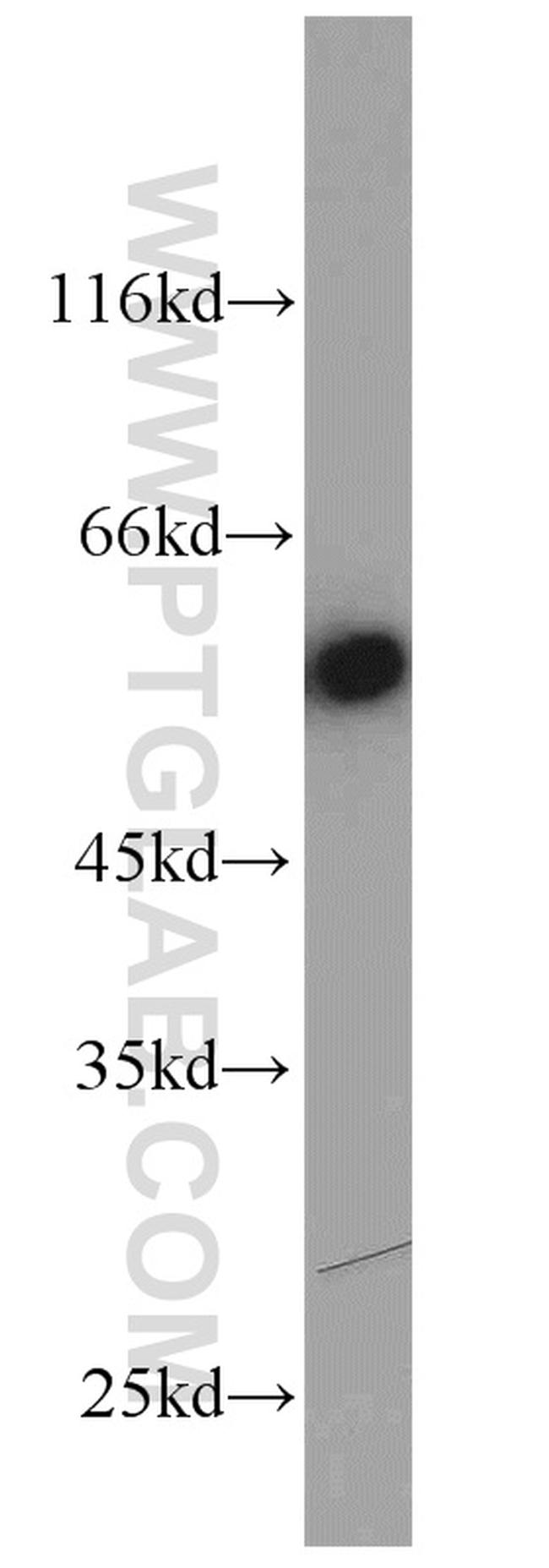 PSMD4 Antibody in Western Blot (WB)