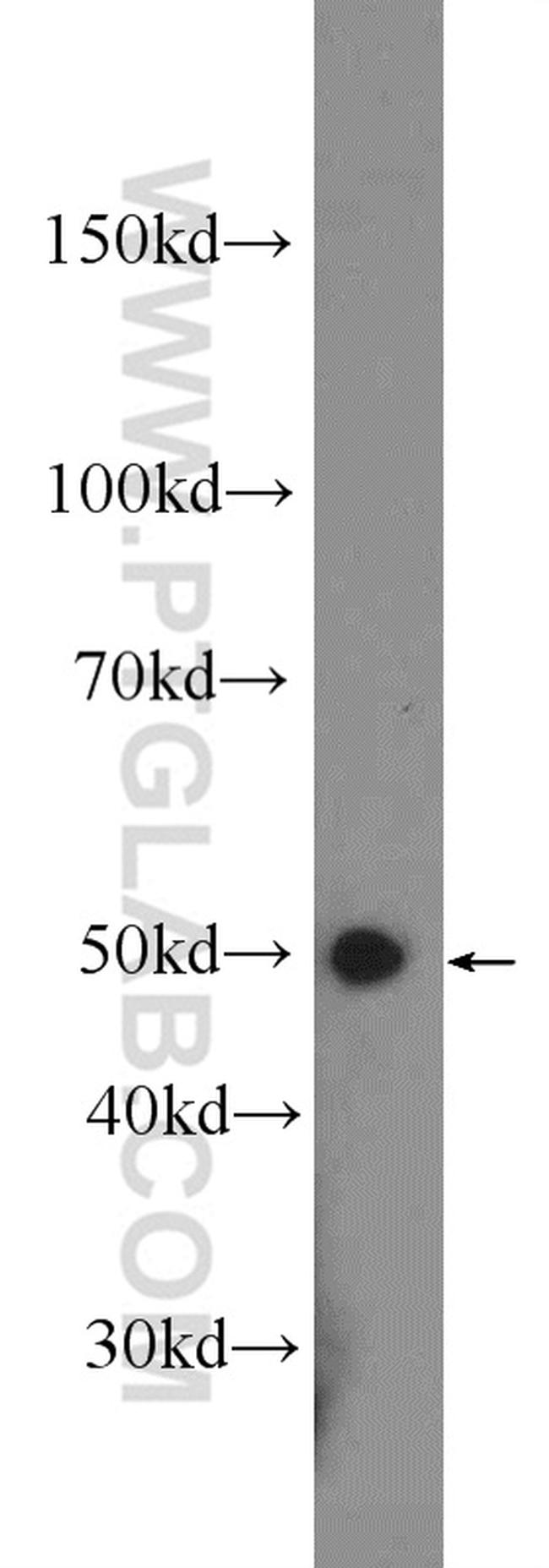 PSMD4 Antibody in Western Blot (WB)