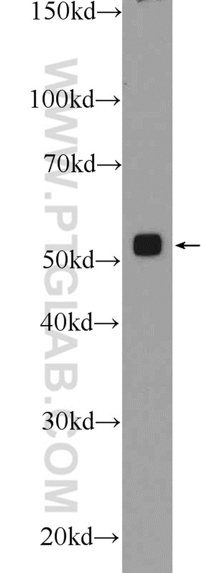 PSMD4 Antibody in Western Blot (WB)