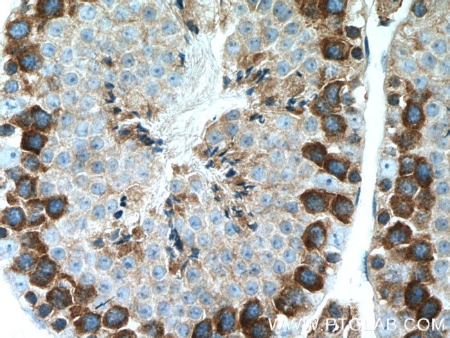 AARSD1 Antibody in Immunohistochemistry (Paraffin) (IHC (P))