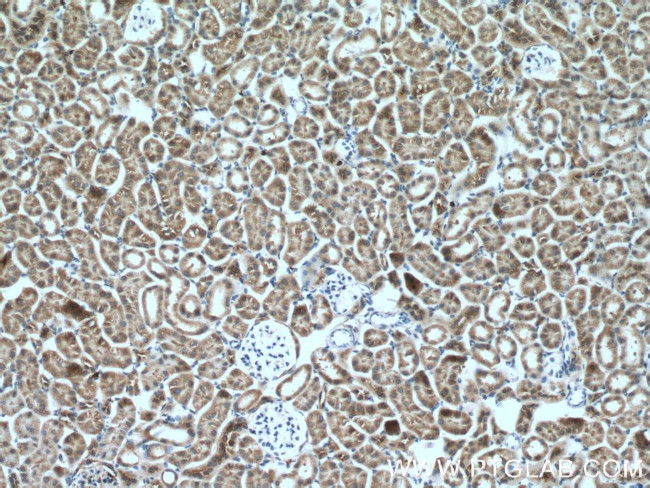 AARSD1 Antibody in Immunohistochemistry (Paraffin) (IHC (P))