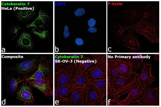 Cytokeratin 7 Antibody