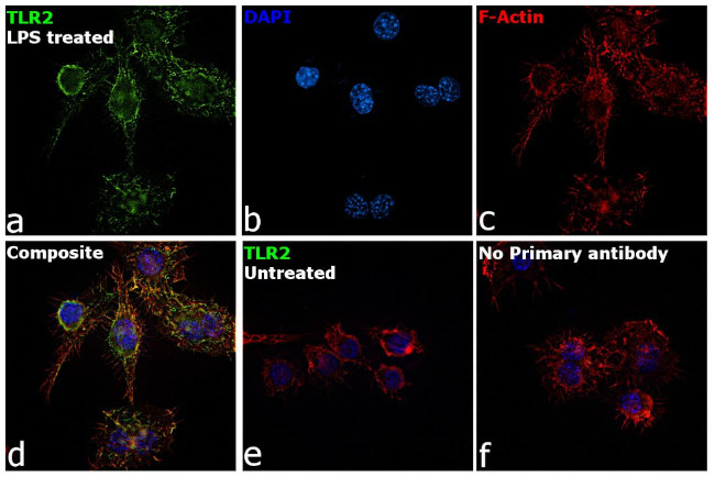 CD282 (TLR2) Antibody in Immunocytochemistry (ICC/IF)