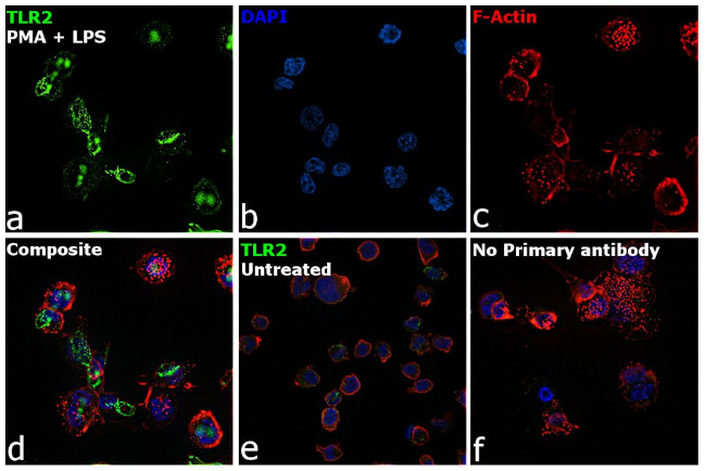 CD282 (TLR2) Antibody in Immunocytochemistry (ICC/IF)