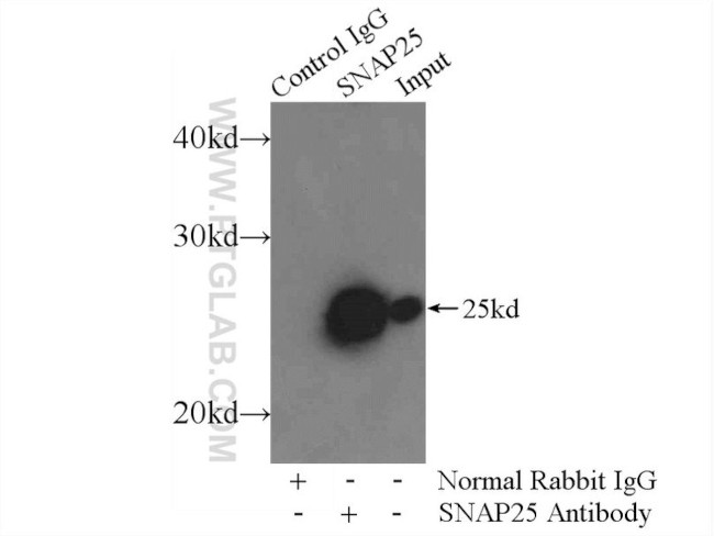 SNAP25 Antibody in Immunoprecipitation (IP)