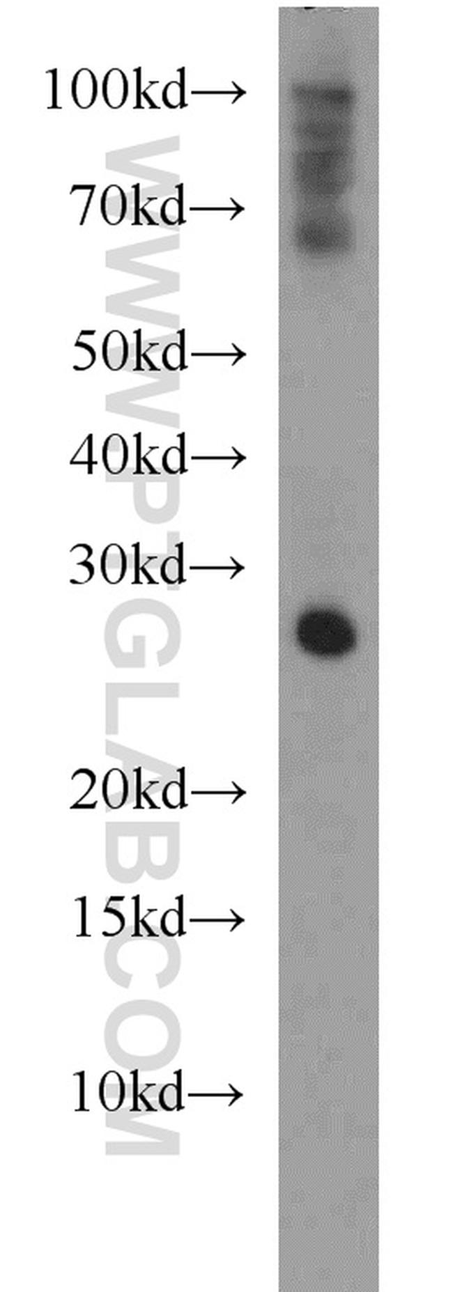 SNAP25 Antibody in Western Blot (WB)