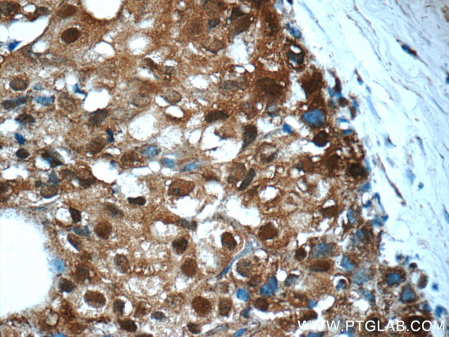 PSMC2 Antibody in Immunohistochemistry (Paraffin) (IHC (P))