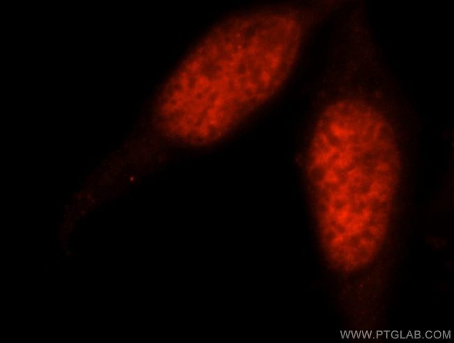 PSME3 Antibody in Immunocytochemistry (ICC/IF)