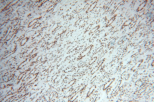 PSME3 Antibody in Immunohistochemistry (Paraffin) (IHC (P))