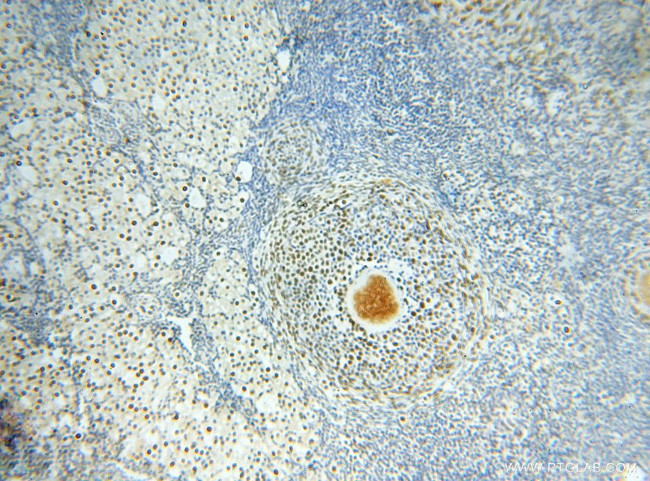 PSME3 Antibody in Immunohistochemistry (Paraffin) (IHC (P))