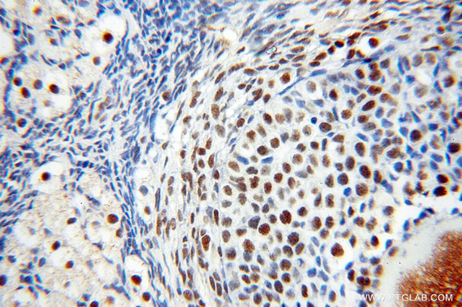 PSME3 Antibody in Immunohistochemistry (Paraffin) (IHC (P))