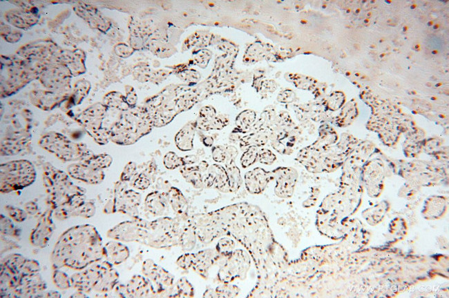 PSME3 Antibody in Immunohistochemistry (Paraffin) (IHC (P))