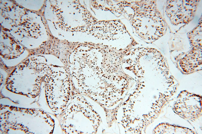 PSME3 Antibody in Immunohistochemistry (Paraffin) (IHC (P))