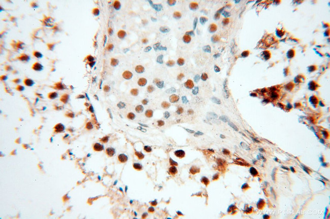 PSME3 Antibody in Immunohistochemistry (Paraffin) (IHC (P))