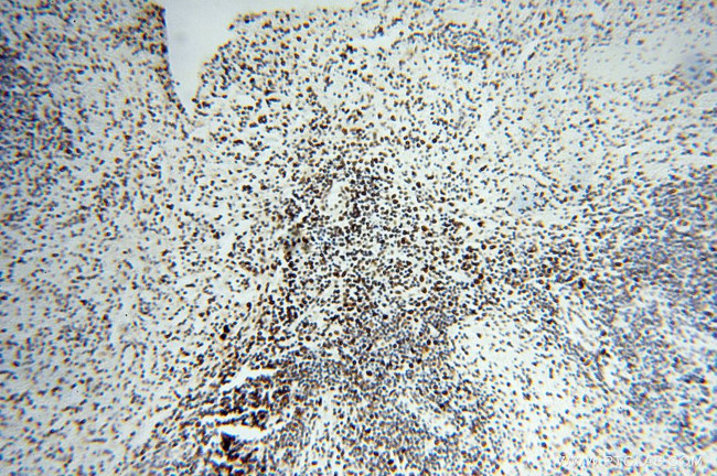 PSME3 Antibody in Immunohistochemistry (Paraffin) (IHC (P))