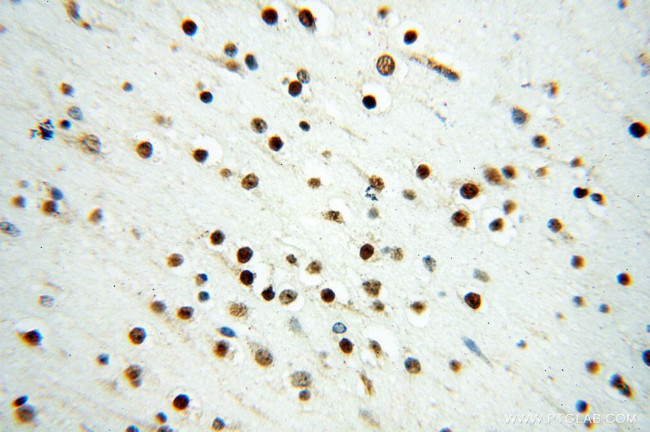 PSME3 Antibody in Immunohistochemistry (Paraffin) (IHC (P))