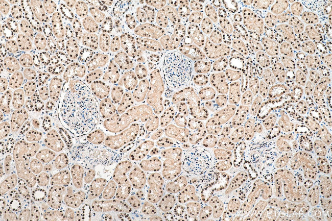 PSME3 Antibody in Immunohistochemistry (Paraffin) (IHC (P))